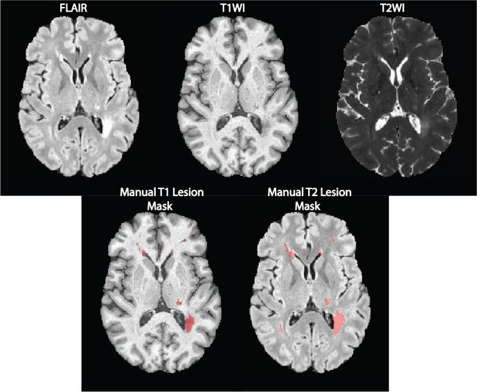 Series of brain scans