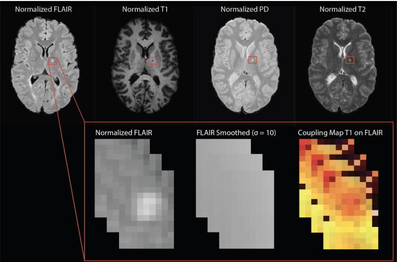 Series of brain scans with areas detailed