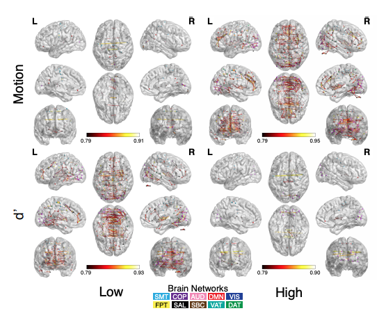 Series of brain scans