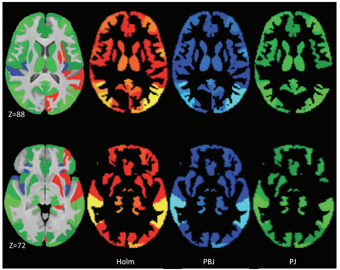 Series of brain scans