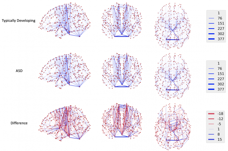 Series of brain scans