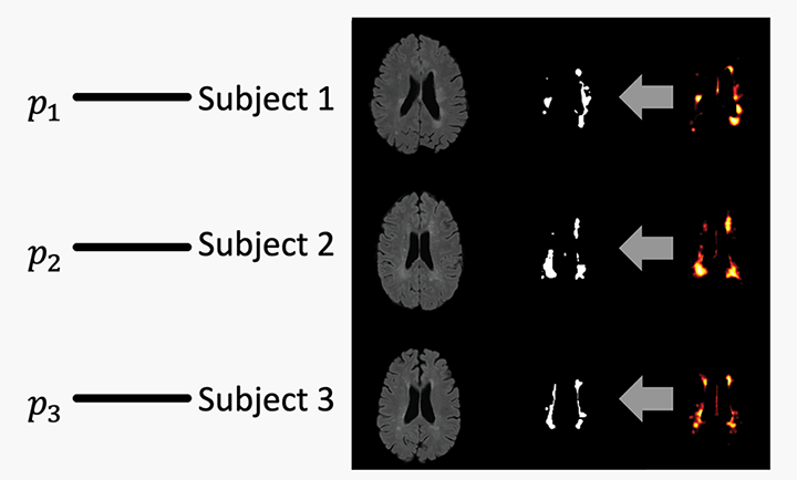 Series of brain scans