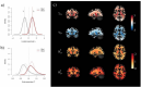 Series of brain scans