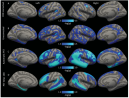 Series of brain scans